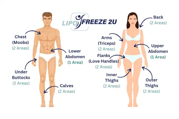 Areas you can have fat freezing treatment Bradford