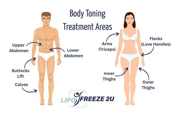Graphic showing where you can have Body toning Treatment Bradford on your body