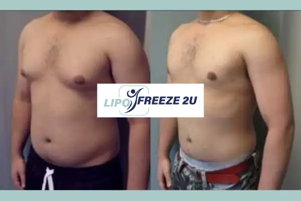 How Long Does It Take to See Results Bradford?