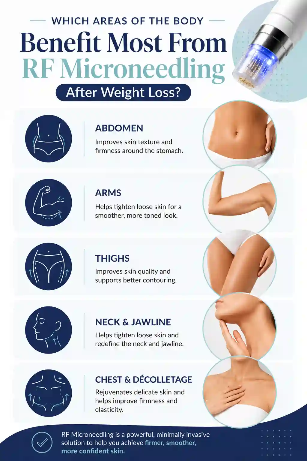 Which Areas of the Body Benefit Most From RF Microneedling After Weight Loss Bradford